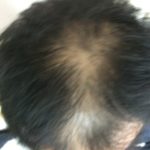 髪を太くする前